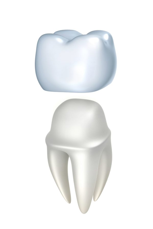 Dental Crowns