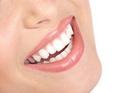 Three Things You Should Know about Porcelain Veneers