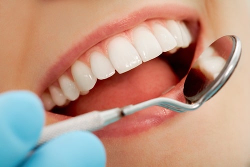 Dental Flaws and Cosmetic Bonding