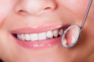 Dental Care Tips for Preventing Gum Disease